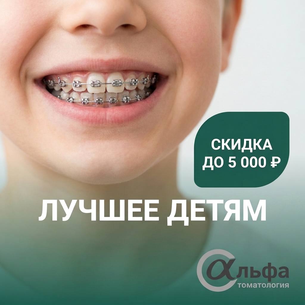 Лучшее детям: брекет-система